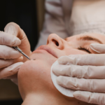 Is Melasma Dangerous?