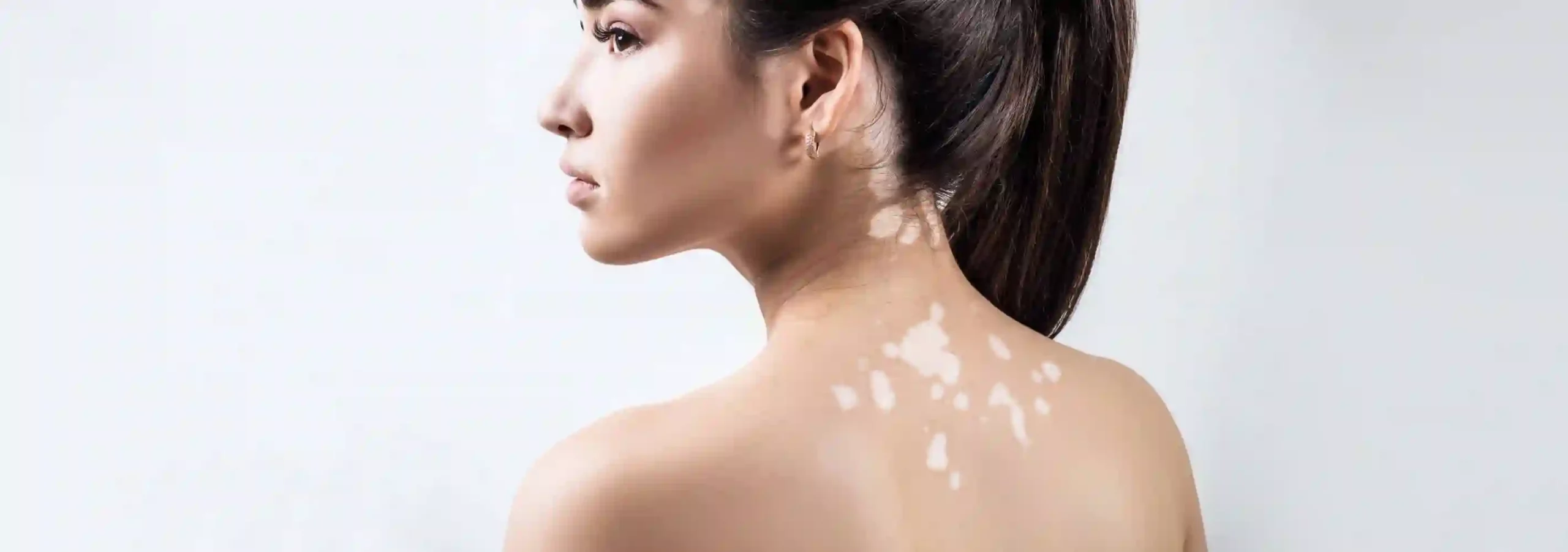 Aluer-Skin clinic in calicut